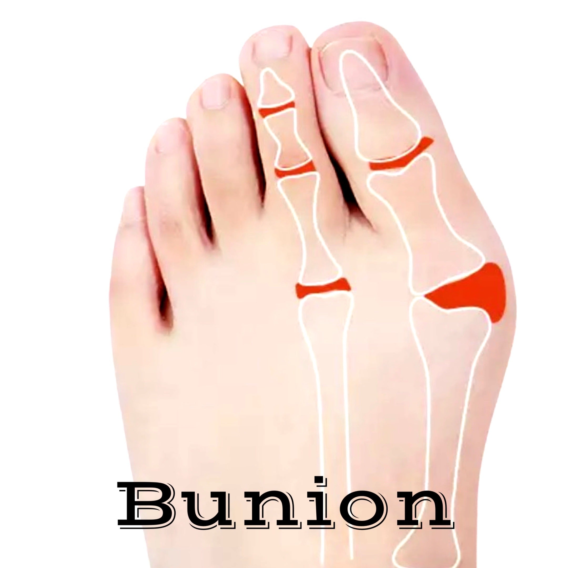 Bunion and Barefoot shoes – Foot Buddy