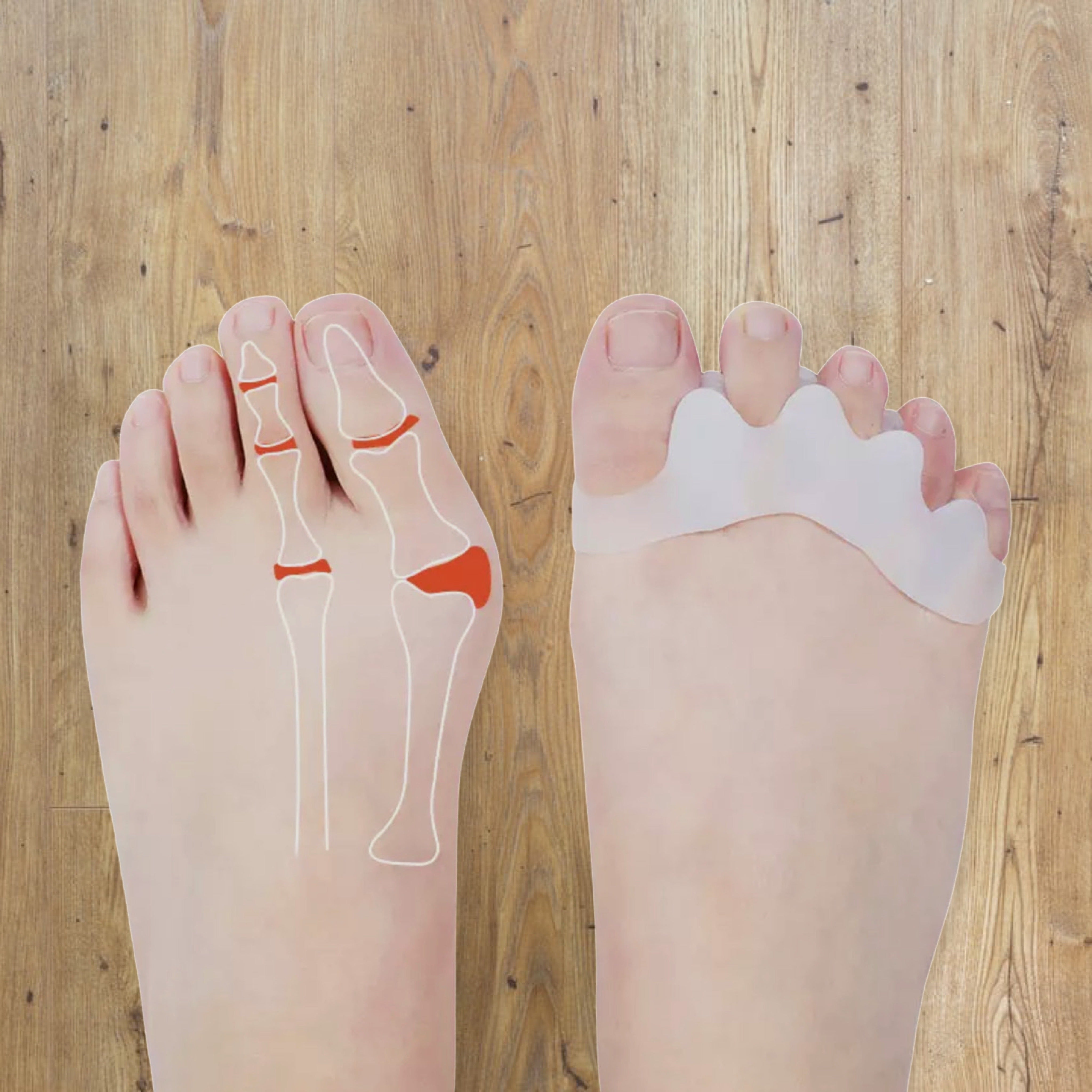 Toe spacers with @wellbybelle #foot #feet #shoes #barefoot #health #le, barefoot shoes